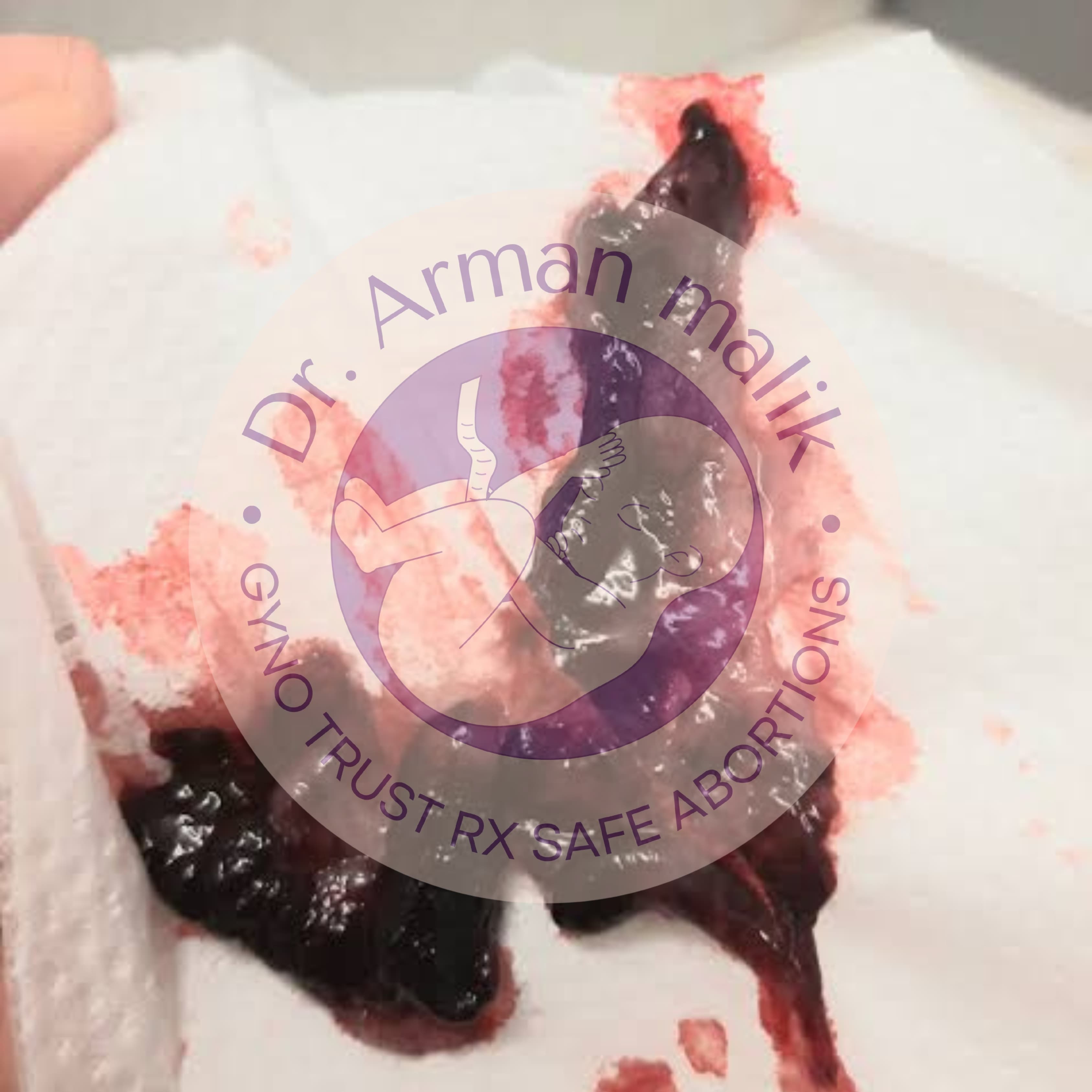 WhatsApp Image 2025-02-24 at 6.48.31 PM.jpeg